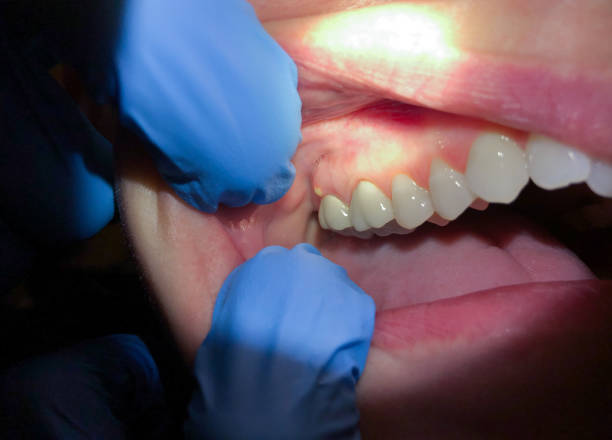 Best Mobile Emergency Dentist in Newbern, TN
