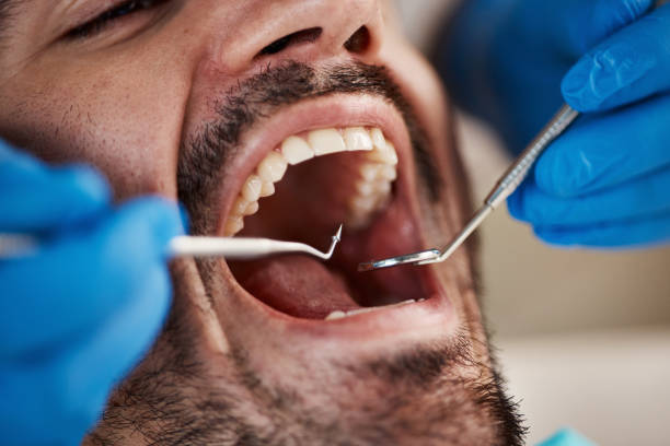 Best Emergency Dentist for Lost Fillings or Crowns in Newbern, TN