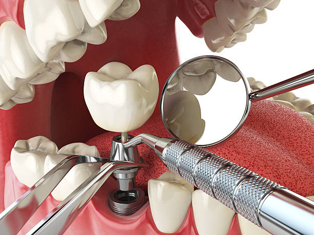 Best Emergency Cosmetic Dentistry in Newbern, TN
