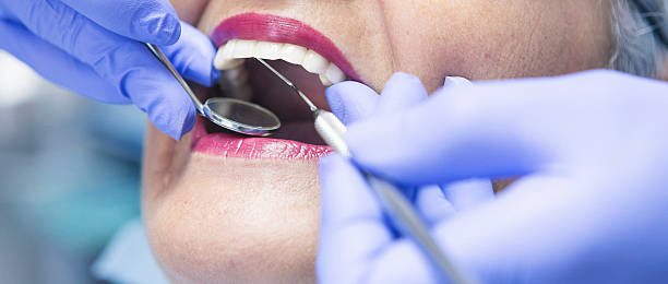 Best Emergency Root Canal Treatment in Newbern, TN